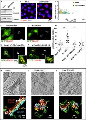 Activity of the SNARE Protein SNAP29 at the Endoplasmic Reticulum and Golgi Apparatus